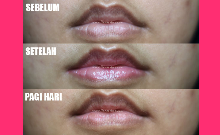 teratu beauty lip tinted bibir hitam